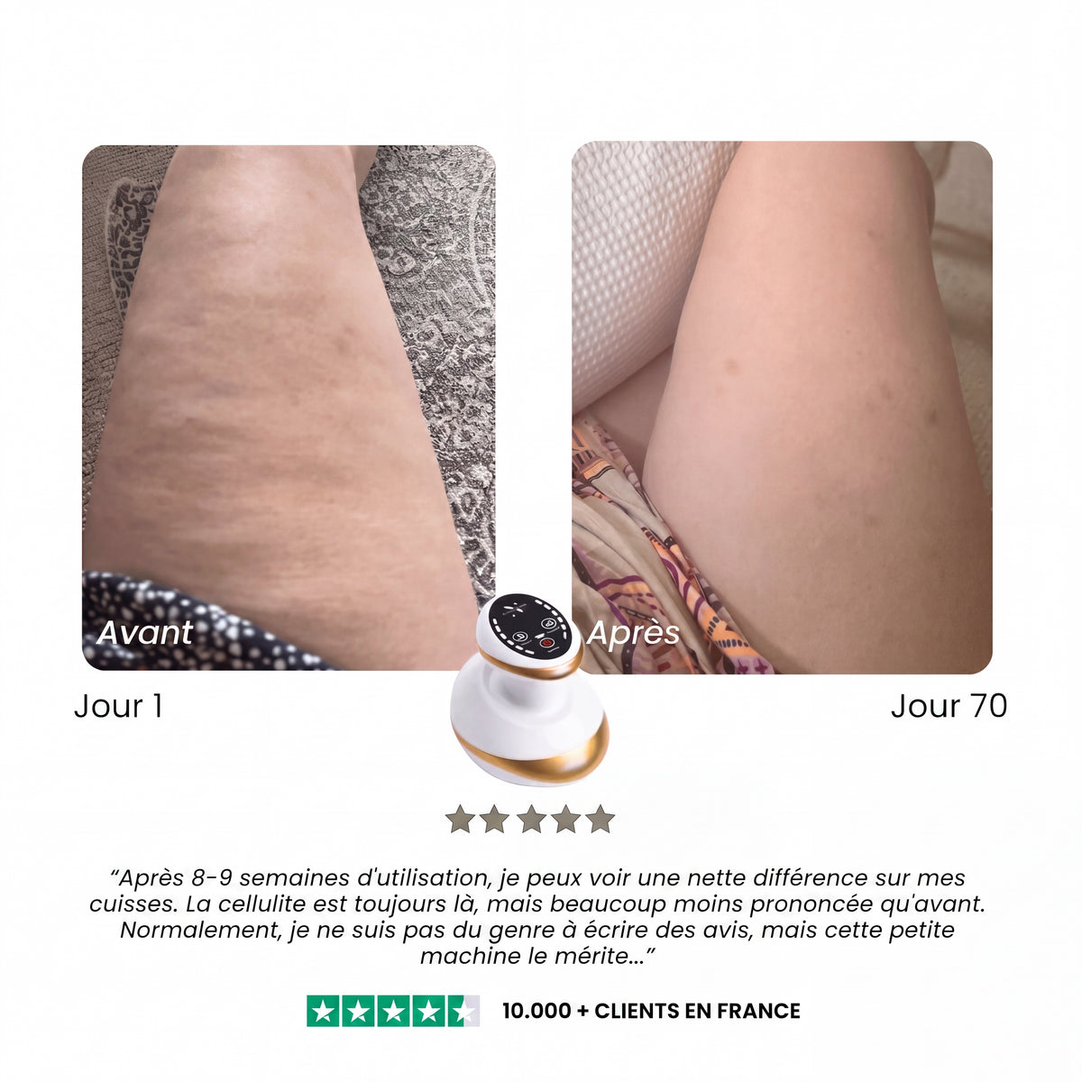 Pandore Sculpt™ | Soin anti-cellulite à domicile